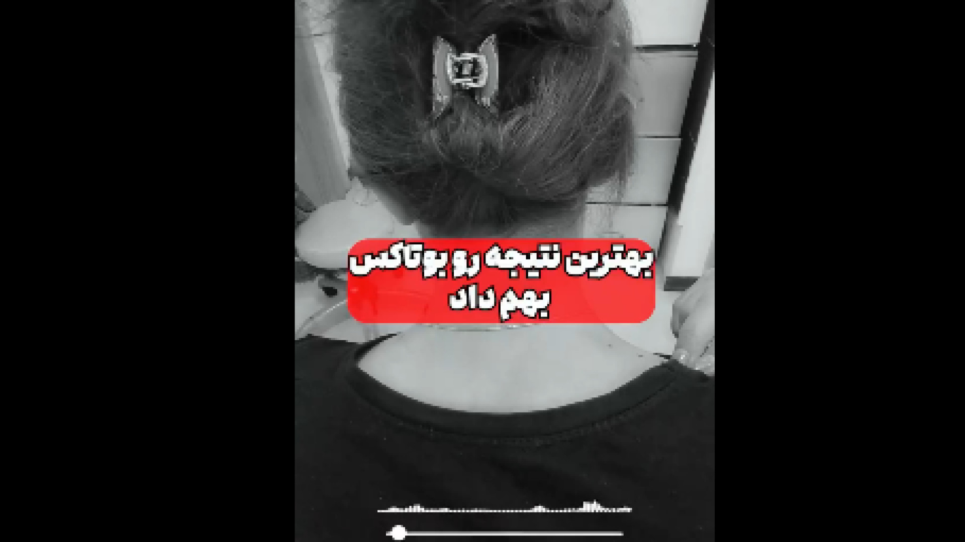 درمان میگرن با تزریق بوتاکس دکتر پروانه ساکت - متخصص پوست و مو، زیبایی