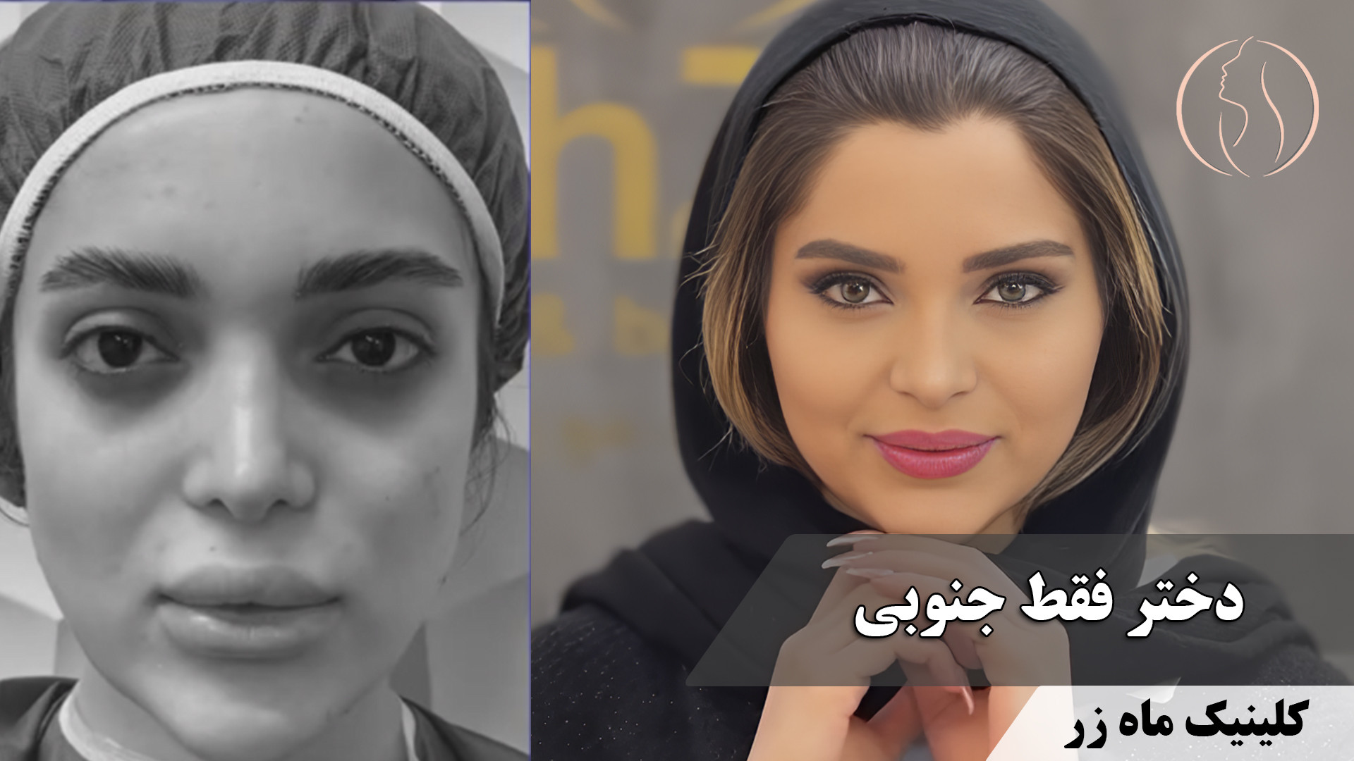 زیبایی از جنوب می‌آید! ️ ( کلینیک زیبایی ماه زر ) بیماری سندروم آلاژیل