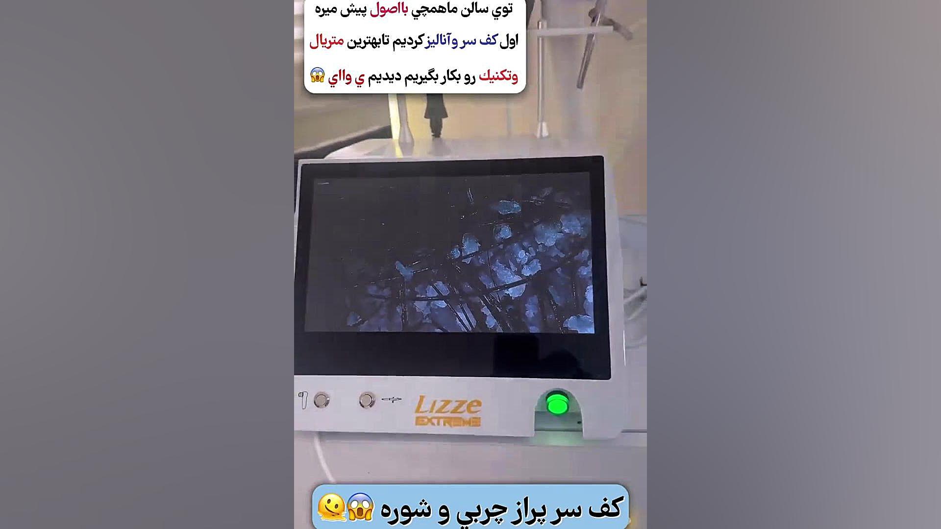 آموزش رایگان اسکالپ سر با دستگاه آنالیز تبلتی و اسکراپ آیسانلی و یوگی تهمورس پورناظری