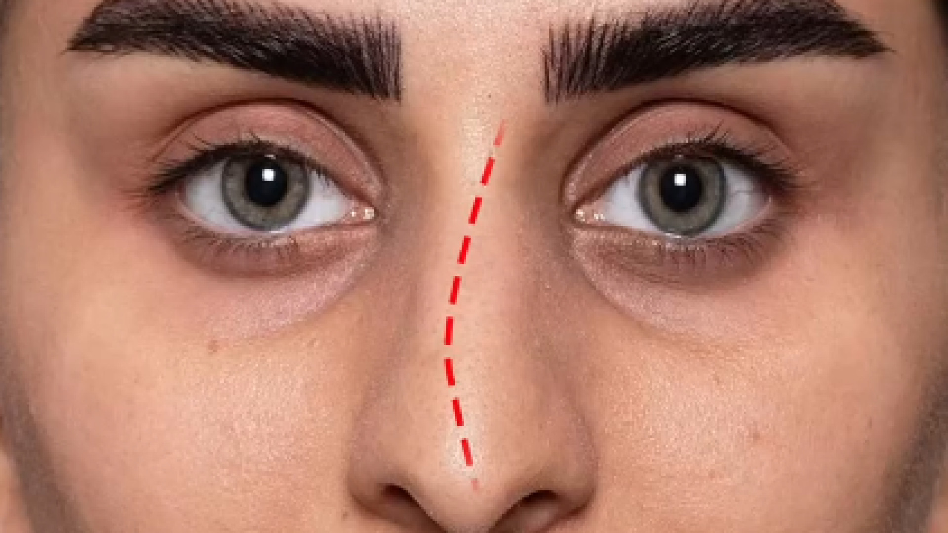 جراحی زیبایی بینی | دکتر علی باقری حق دکتر علی باقری حق