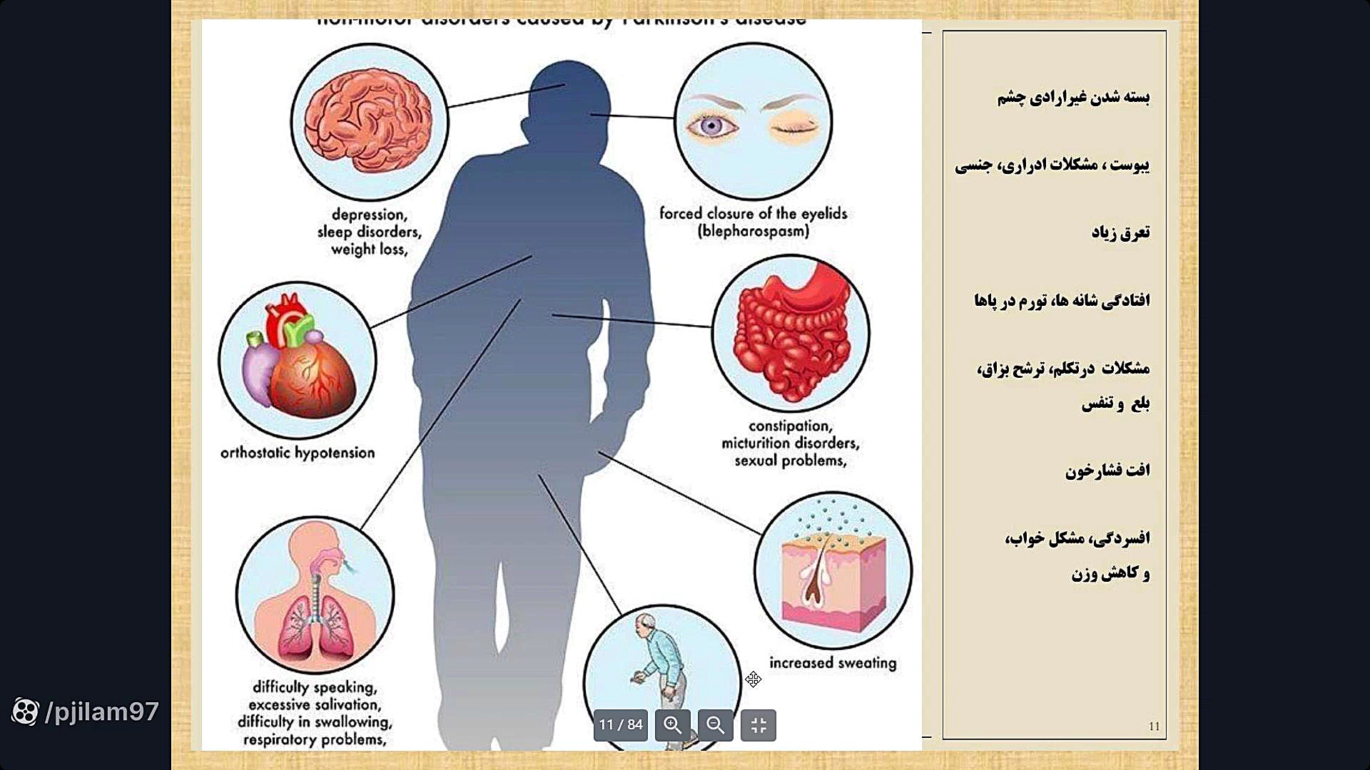 وبینار آشنایی با بیماری پارکینسون پاکسازی پوست