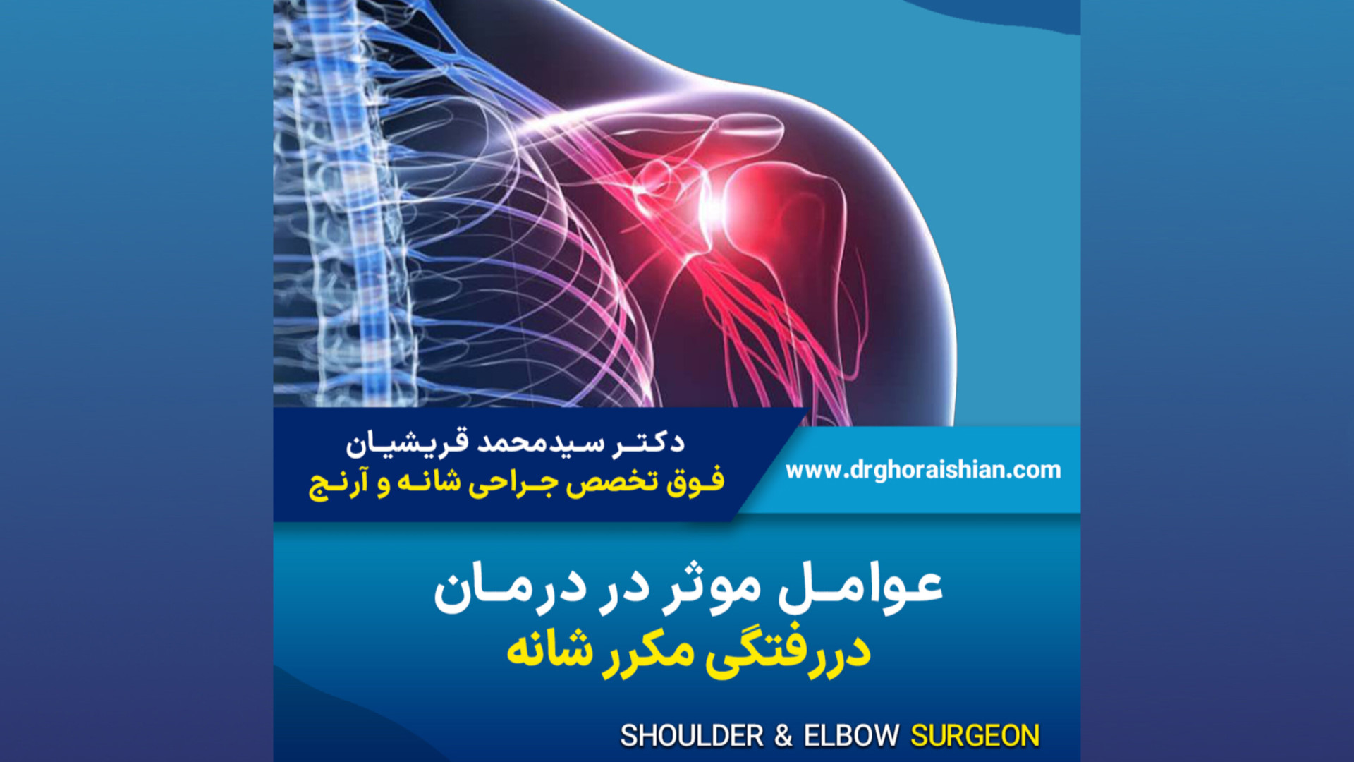 عوامل موثر در درمان دررفتگی مکرر شانه استفان کری