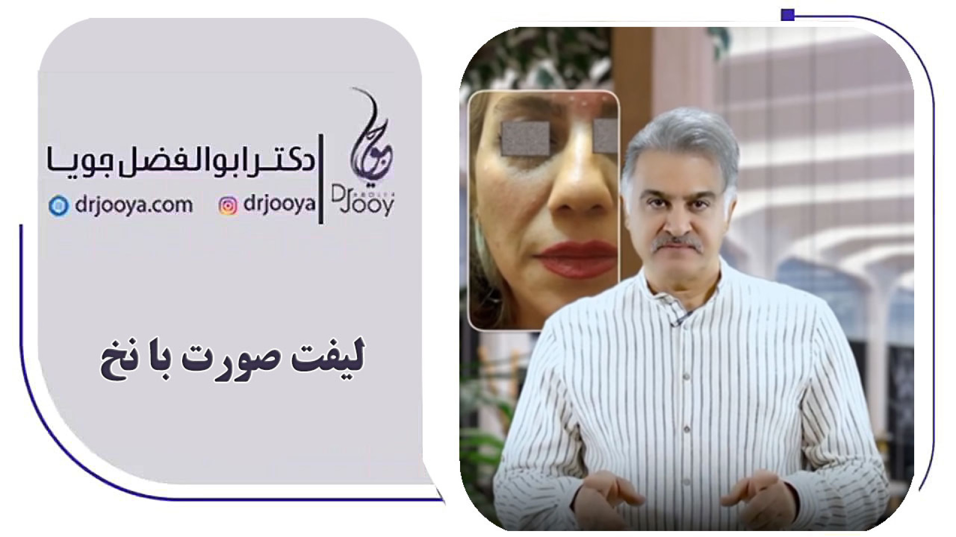جوانی صورت بدون جراحی با نخ های لیفت! دکتر ابوالفضل جویا