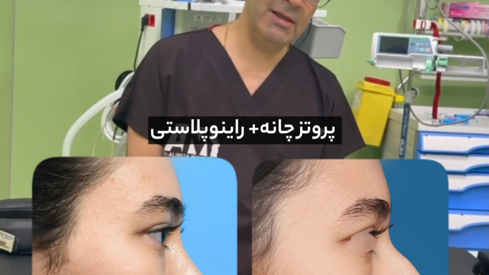 جراحی همزمان پروتز چانه + ژنیوپلاستی و راینوپلاستی با دکتر محبی