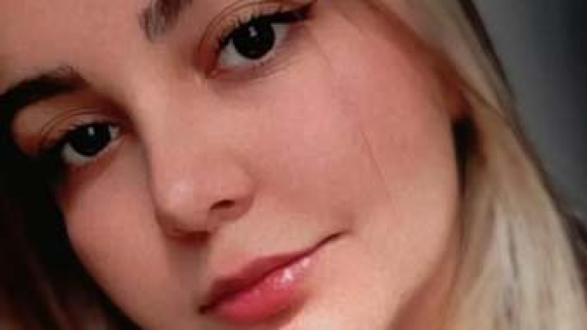 رینوپلاس| دکتر علی باقری حق دکتر علی باقری حق