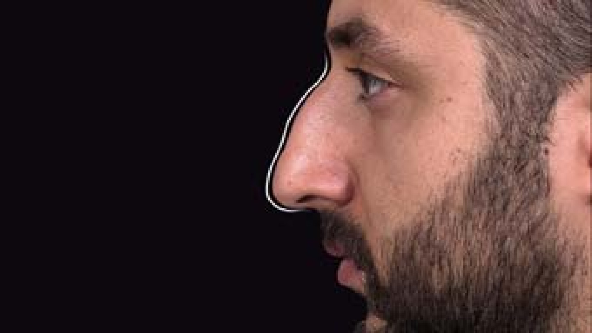 جراحی بینی شیک و مردونه | دکتر علی باقری حق دکتر علی باقری حق