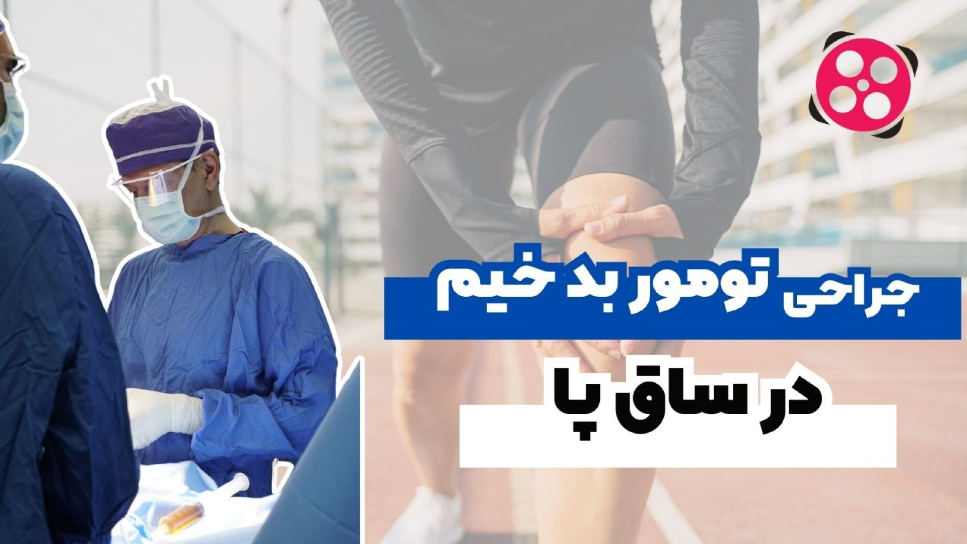 جراحی تومور بدخیم در ساق پا! دکتر محمود جعفر بیگلو