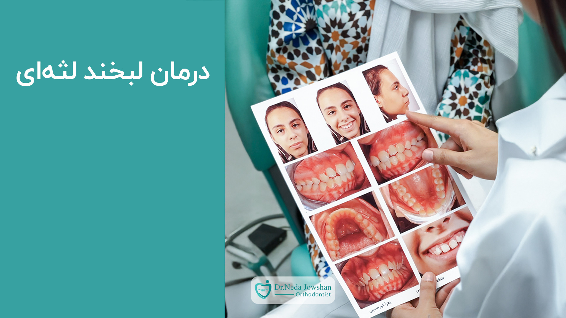 رضایت زیبا جوی عزیزمون از درمان لبخند لثه ای - دکتر ندا جوشن مزوتراپی