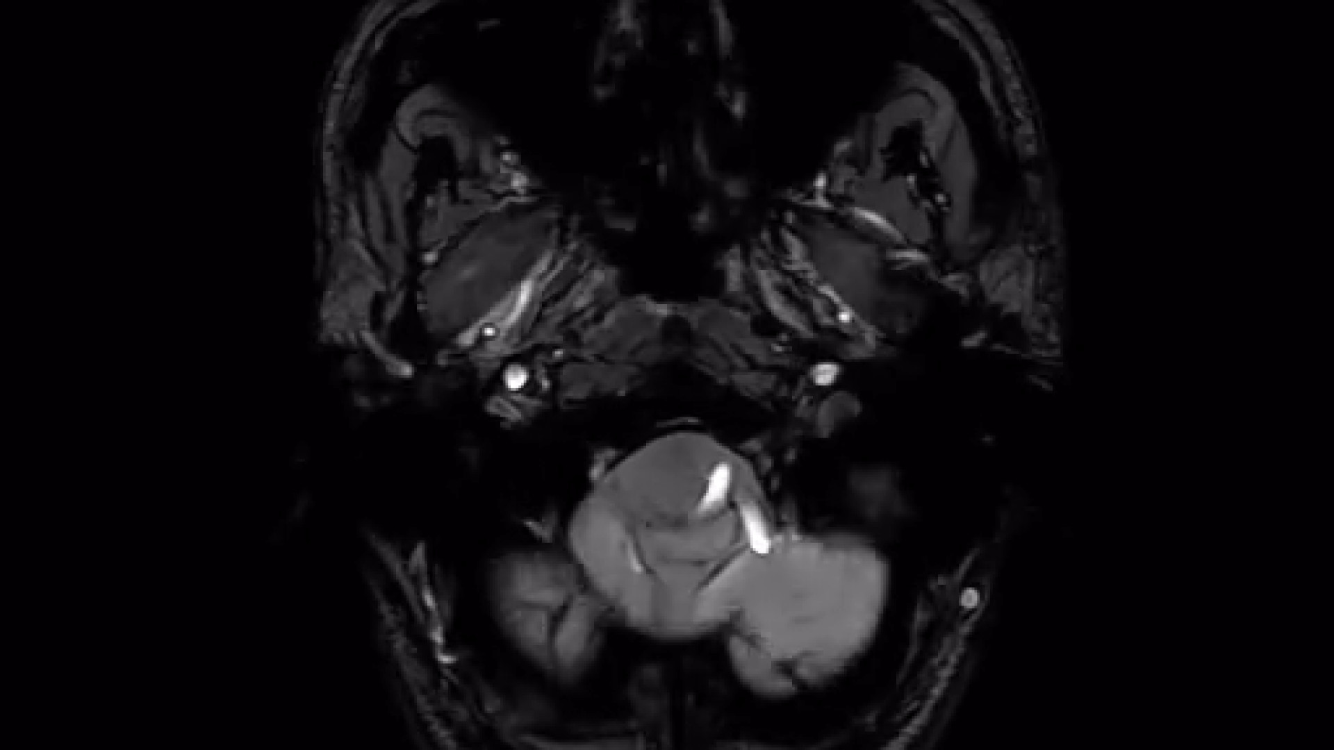 همه چیز درباره MRI مغز مد روز