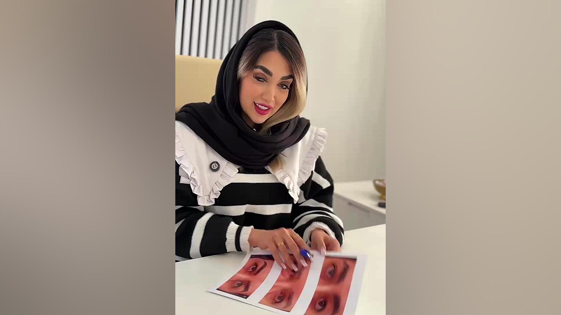 بلفاروپلاستی | جراحی زیبایی پلک برای چشمانی جوان‌تر تست مهارکننده کمپلیمانت
