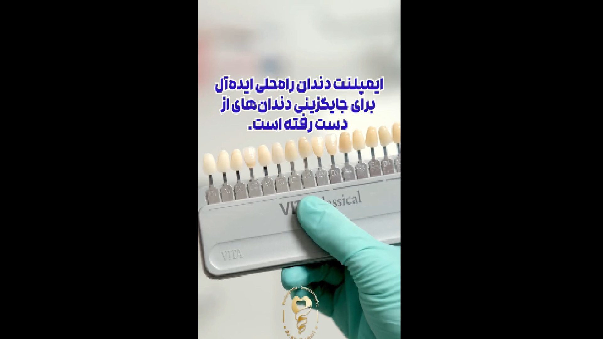 همه میتونن ایمپلنت کنن؟ دکتر علی قمری - متخصص جراحی لثه و ایمپلنت