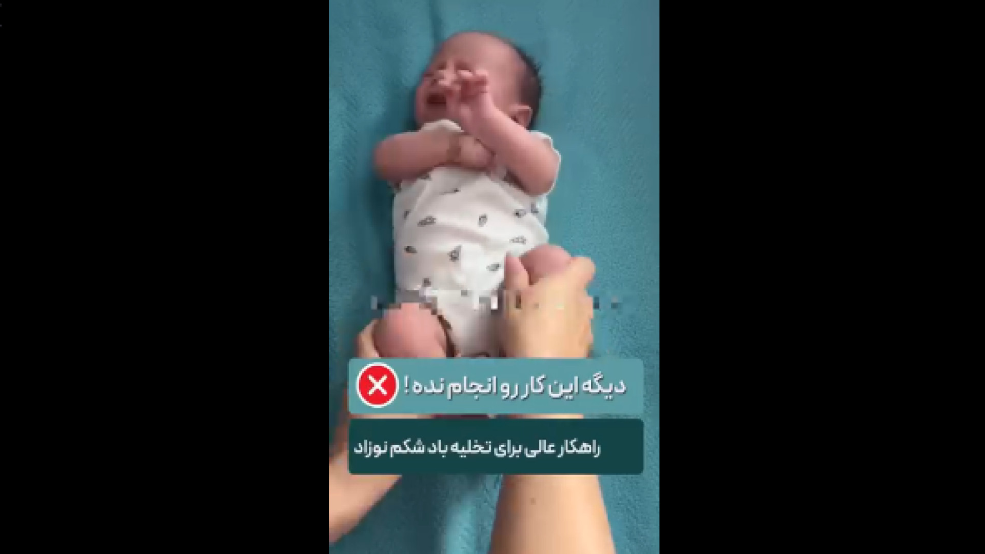 تخلیه باد شکم نوزاد پلاستیک لثه