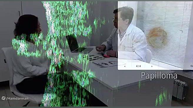 TPM skin scanner تنها دستگاه تخصصی سونوگرافی پوست در دنیا کاشت ریش