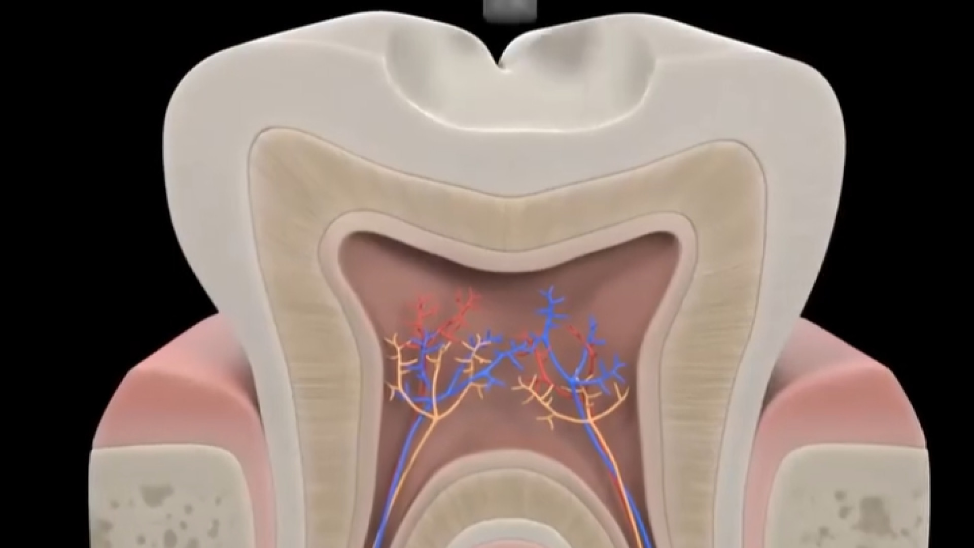 انیمیشن پر کردن دندان دکتر ندا هادی-دندانپزشک زیبایی