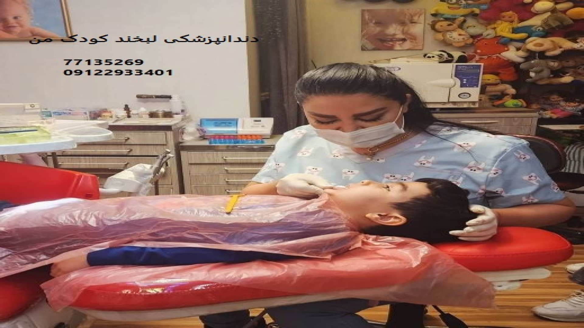 دندانپزشک کودکان تهران پیلینگ شیمیایی
