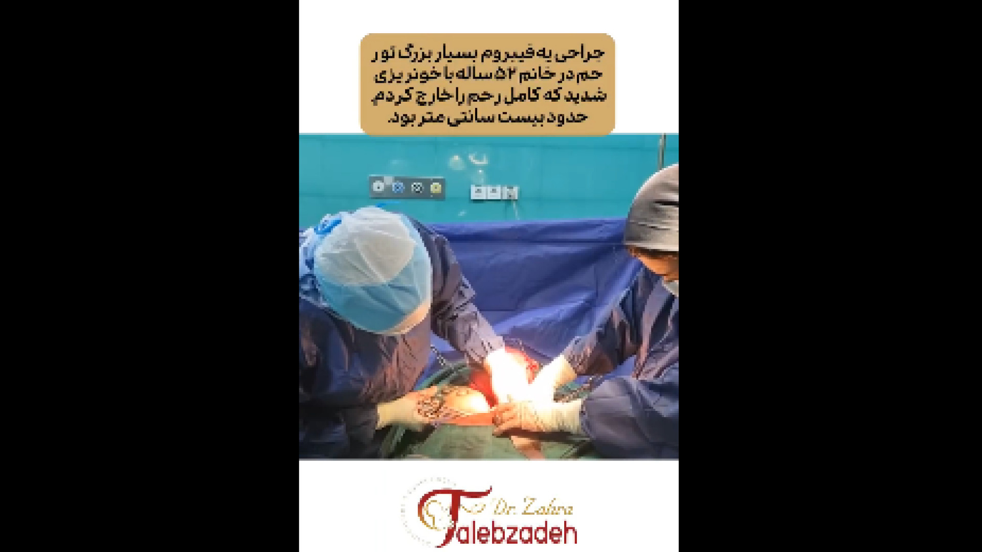 فیلم عمل فیبروم بزرگ در رحم دکتر زهرا طالب زاده
