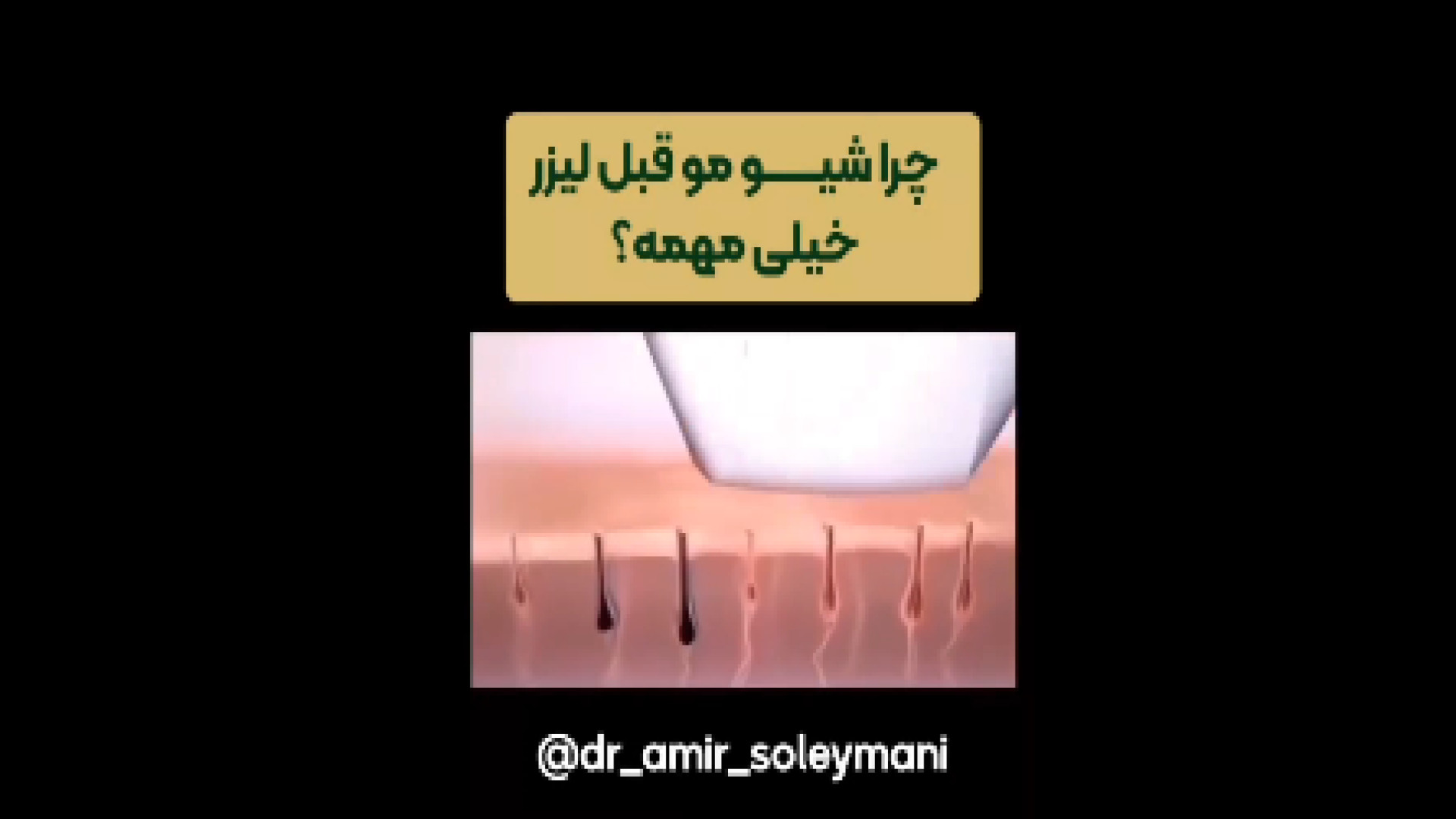 اهمیت شیو کردن قبل از لیزر دکتر امیر سلیمانی