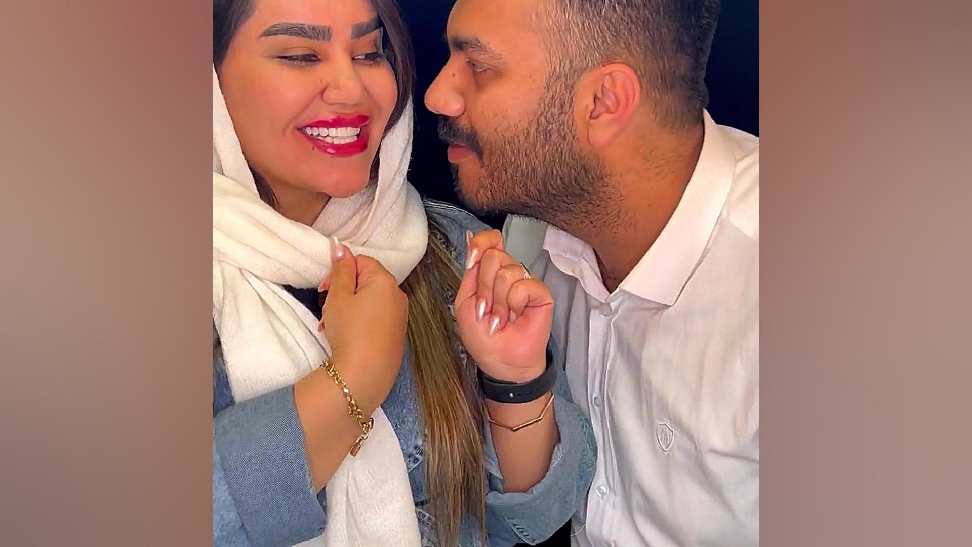 کامپوزیت ونیر دو فک در یک جلسه ایریدوتيكان
