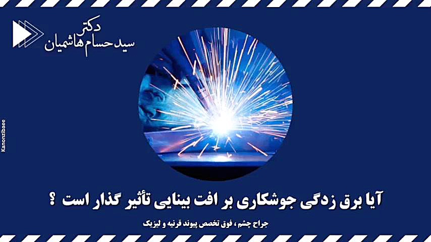 تاثیر برق زدگی جوشکاری بر افت بینایی لیفت پیشانی