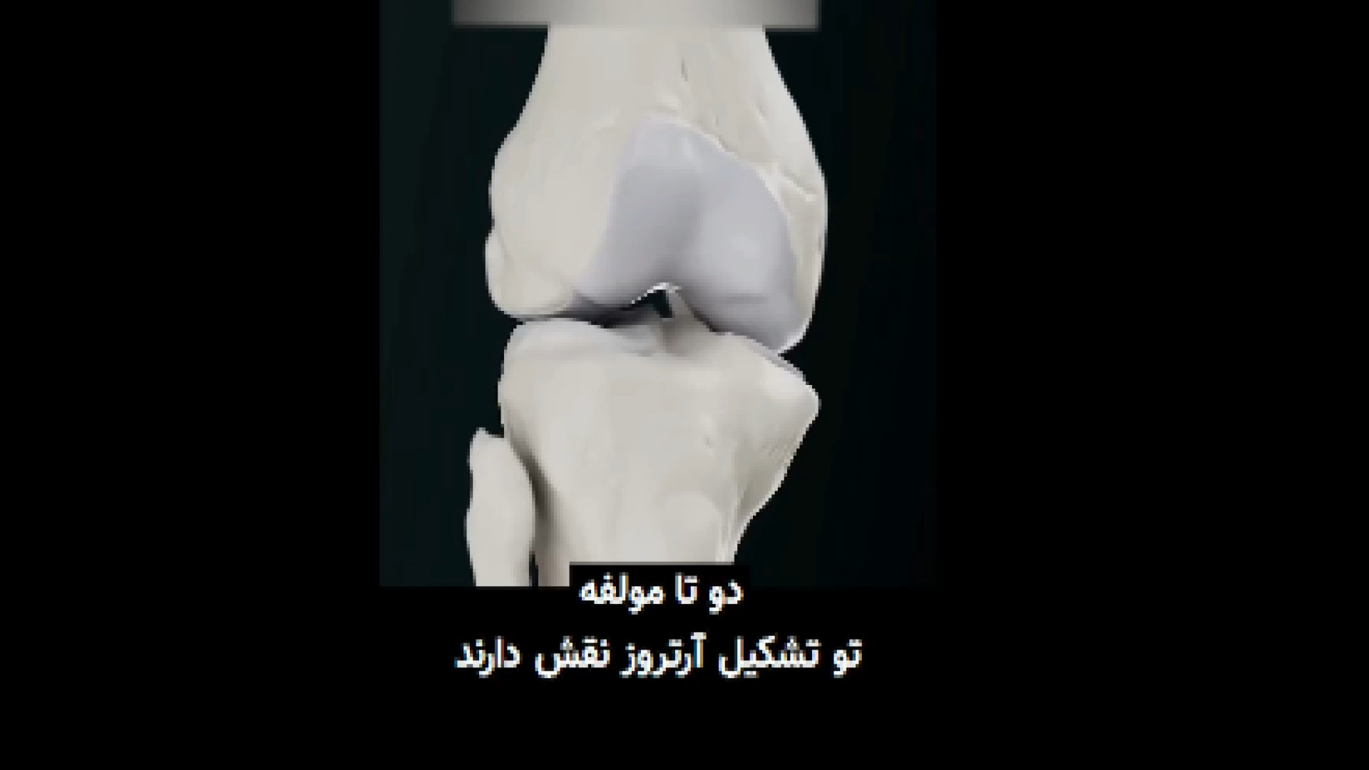 علت آرتروز زانو دکتر آرش اریس