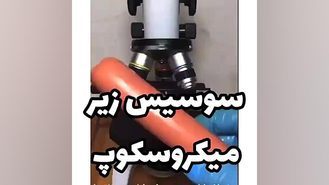 سوسیس زیر میکروسکوپ.(مستند) فالو