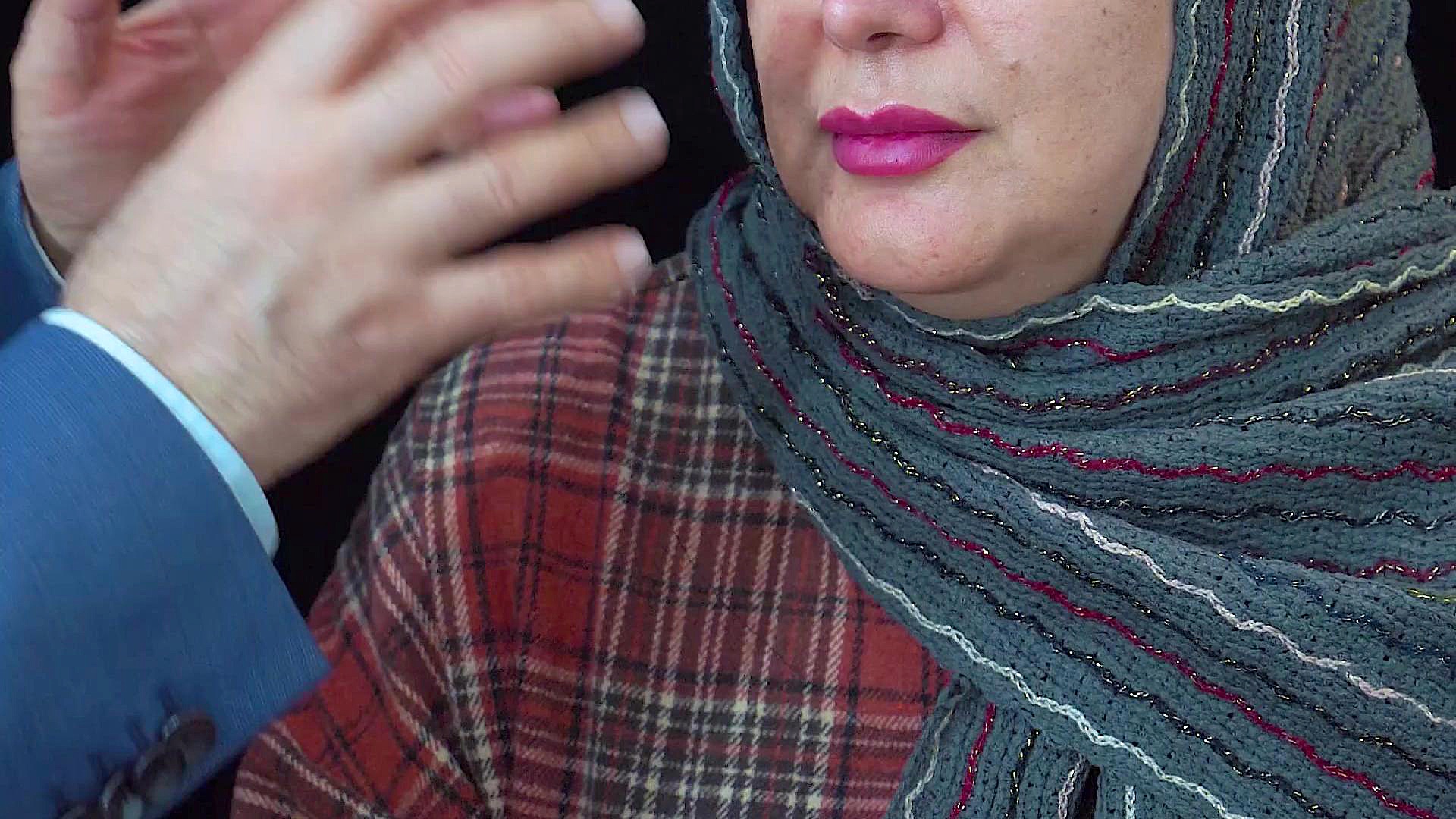 نتایج شگفت انگیز عمل میکروسکوپی بر روی بینی گوشتی دکتر ابراهیم حاتمی پور