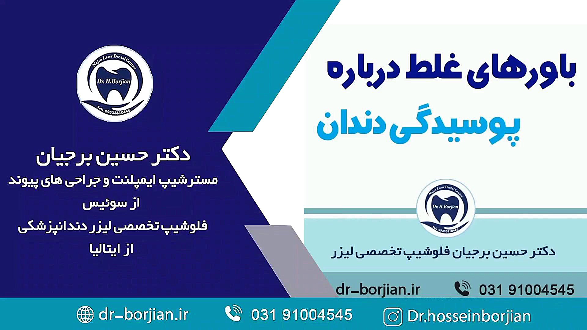 باورهای اشتباه درباره پوسیدگی دندان که باید بدانید پلاستیک لثه