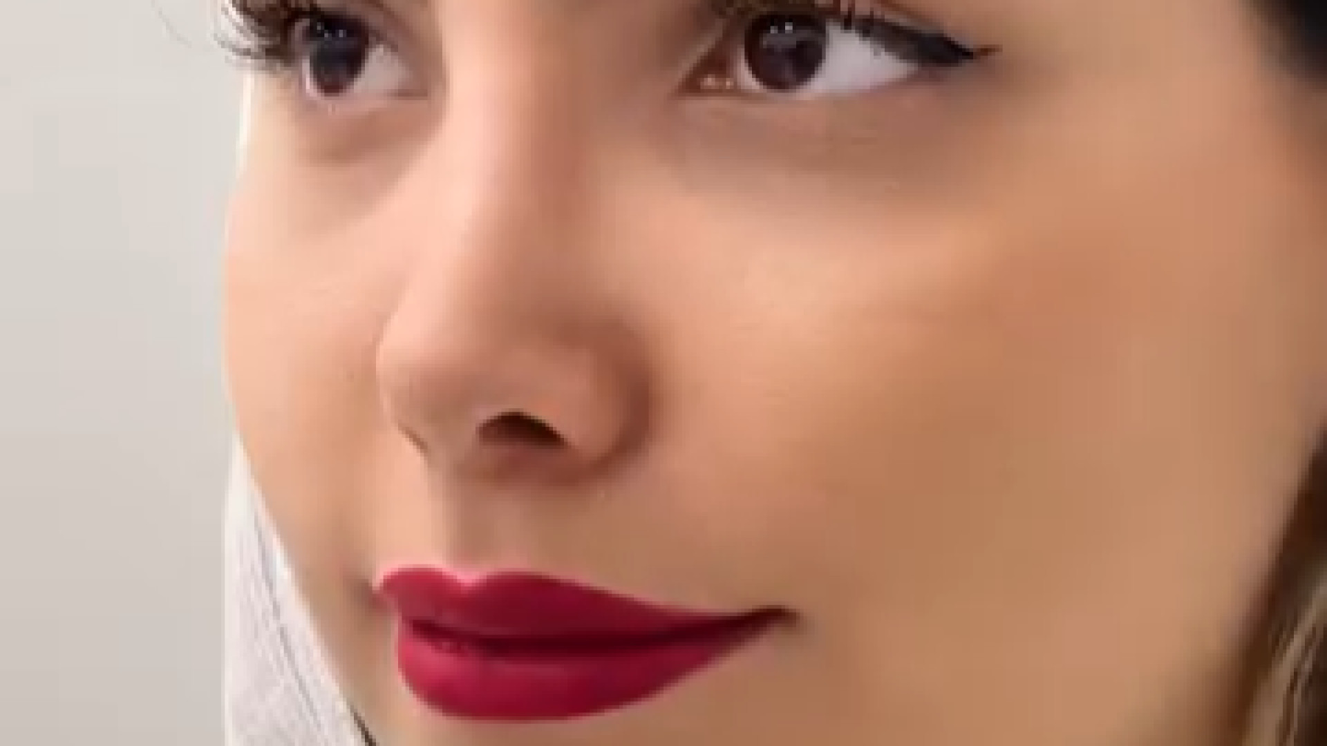 دو هفته از جراحی بینیشون میگذره - دکتر مفرد دکتر حمیدرضا مفرد