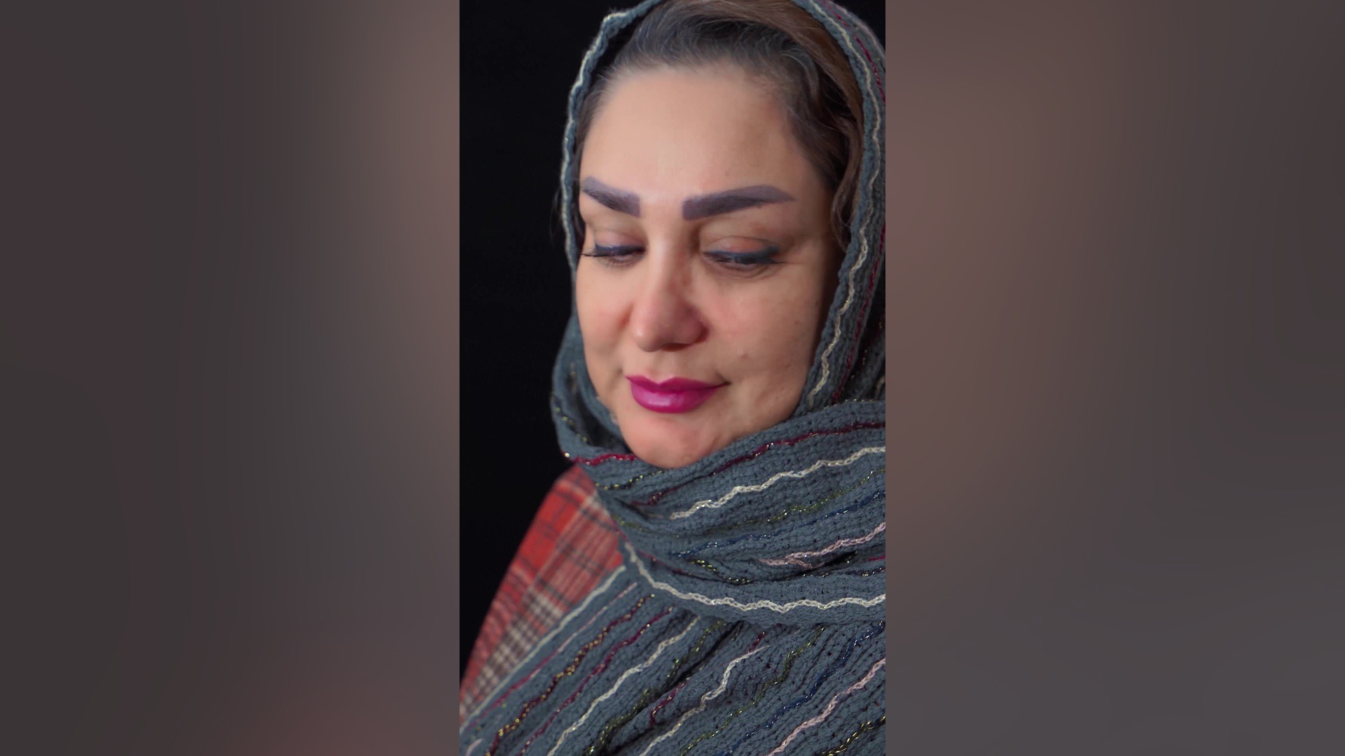 نتایج اثربخش عمل بینی گوشتی بعد از 8 ماه توسط دکتر حاتمی پور دکتر ابراهیم حاتمی پور