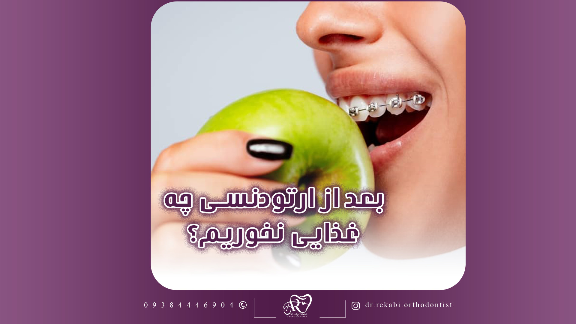 بعد از ارتودنسی چه غذاهایی نخوری؟ دکتر عاطفه رکابی