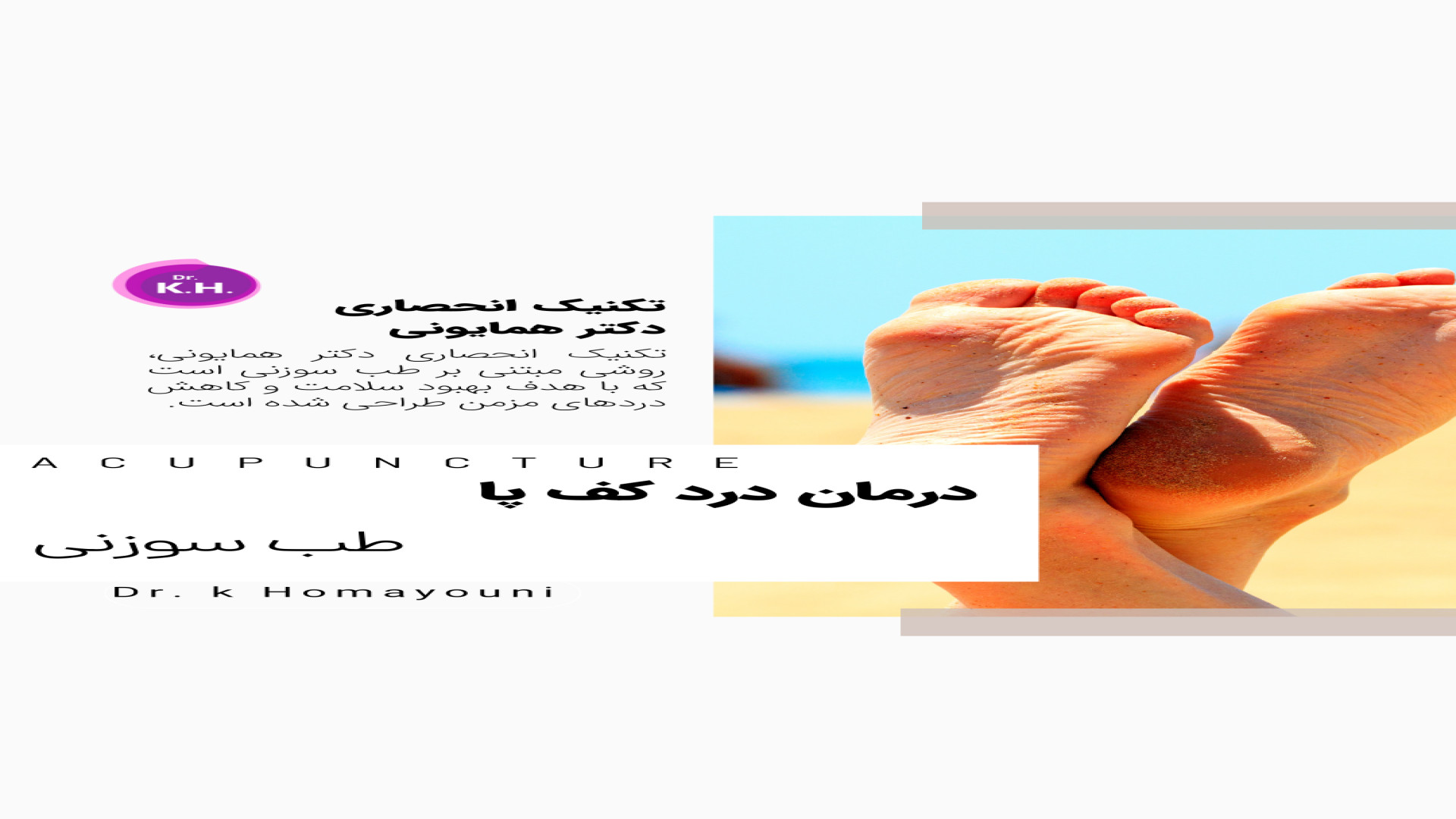 درمان درد کف پا با چند جلسه طب سوزنی پر کردن دندان
