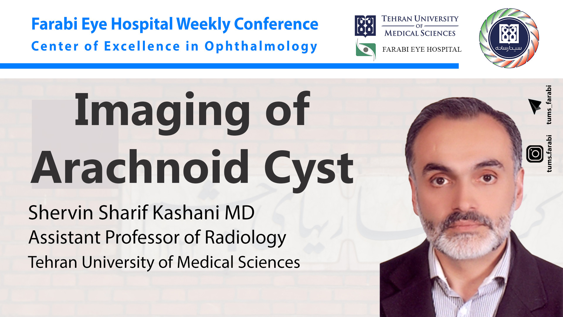 Imaging of Arachnoid Cyst - دکتر شروین شریف کاشانی/دانشگاه علوم پزشکی تهران ChIP-Chip