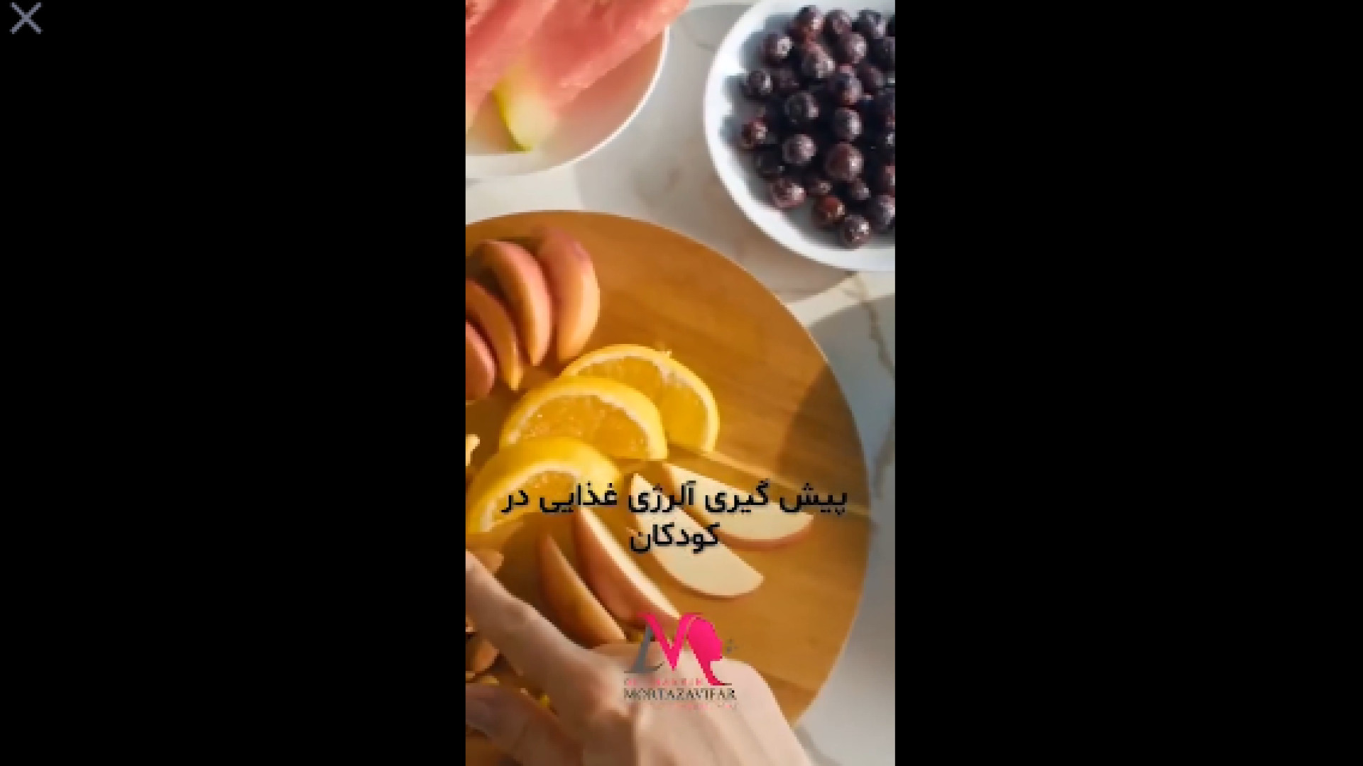 آلرژی غذایی کودکان دکتر نسرین مرتضوی فر