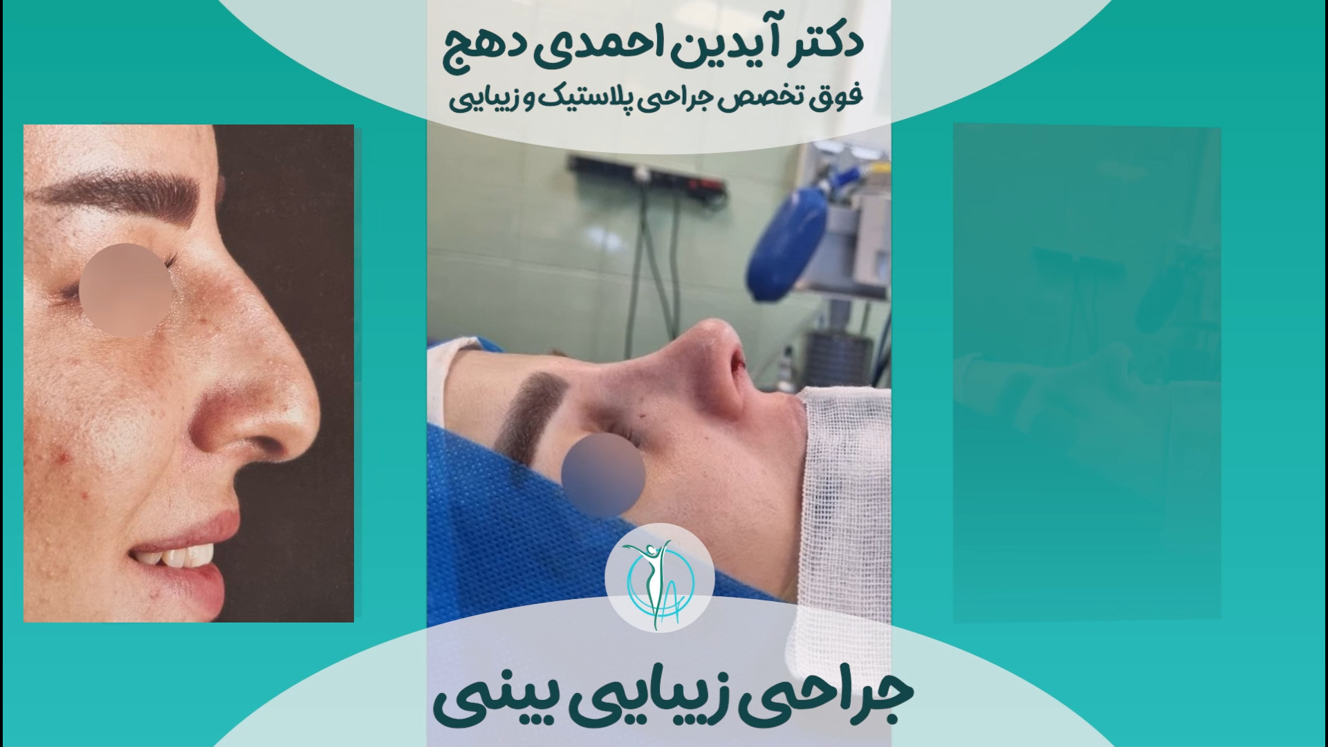 جراحی زیبایی بینی | دکتر احمدی دهج دکتر آیدین احمدی دهج | جراح پلاستیک