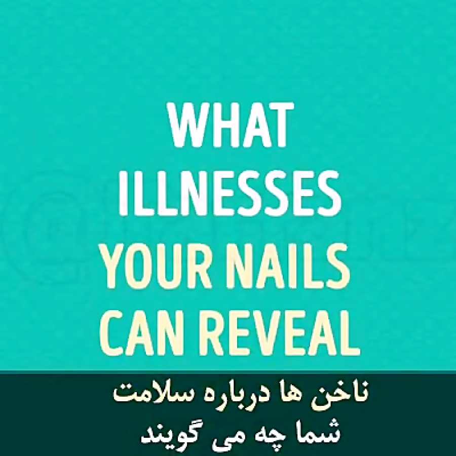 تشخیص بیماری از روی رنگ ناخن