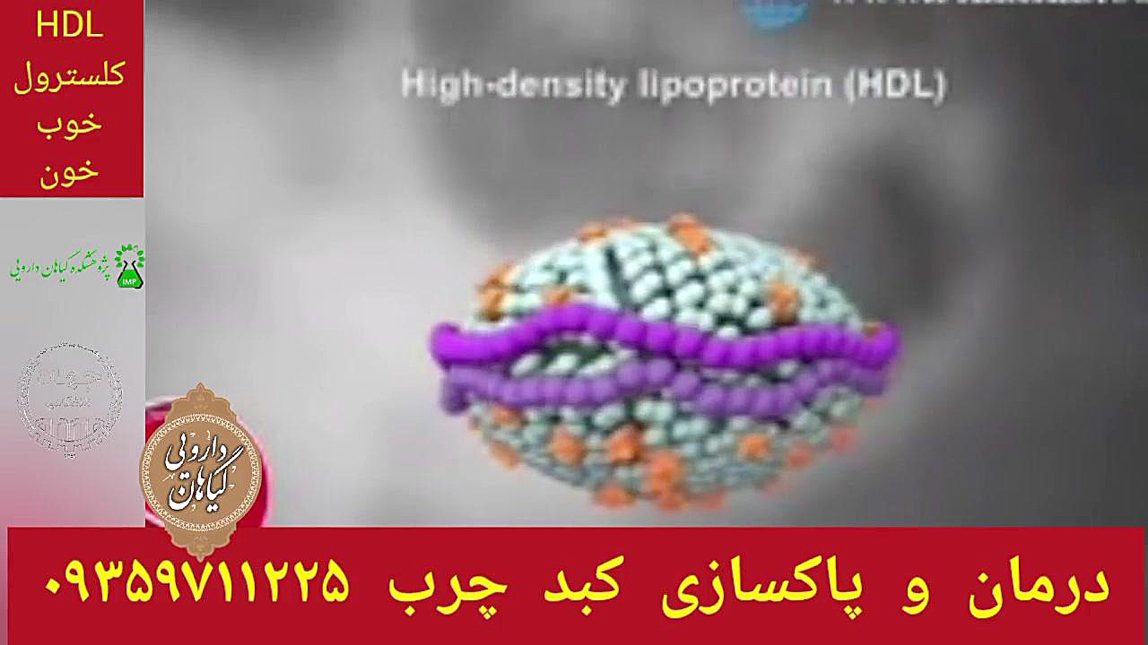 HDL خون درمان و پاکسازی کبدچرب توسط شاگردان حکیم خیراندیش ۰۹۳۵۹۷۱۱۲۲۵ تزریق ژل