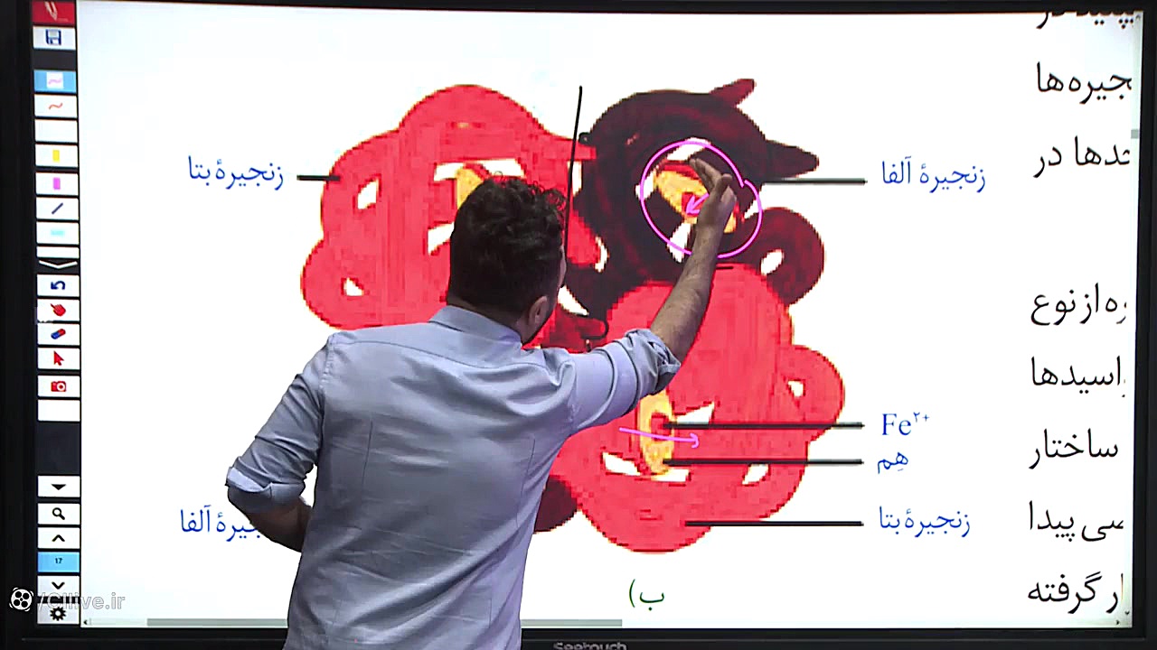 هموگلوبین ( فصل ۱ دوازدهم ) بیماری سندروم آلاژیل