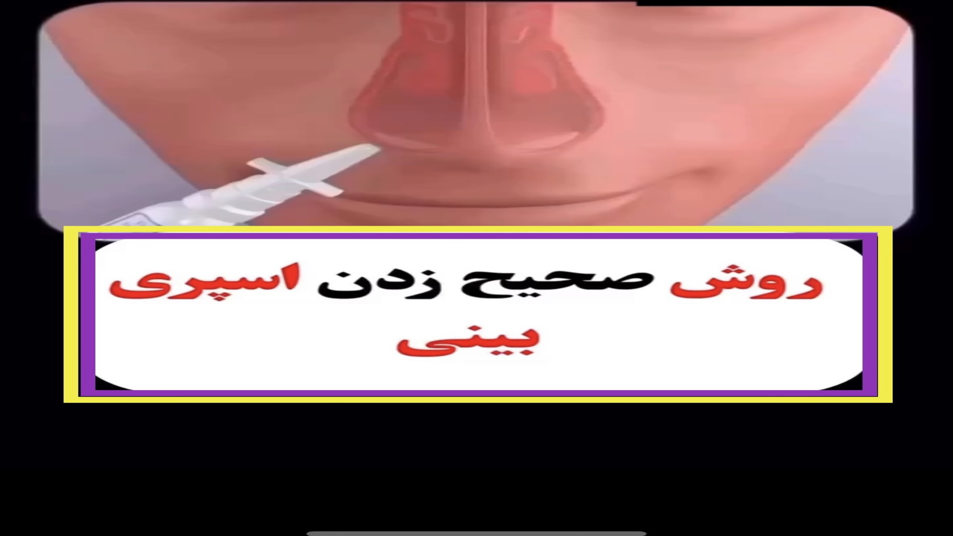 روش صحیح اسپری بینی اندودنتیکس