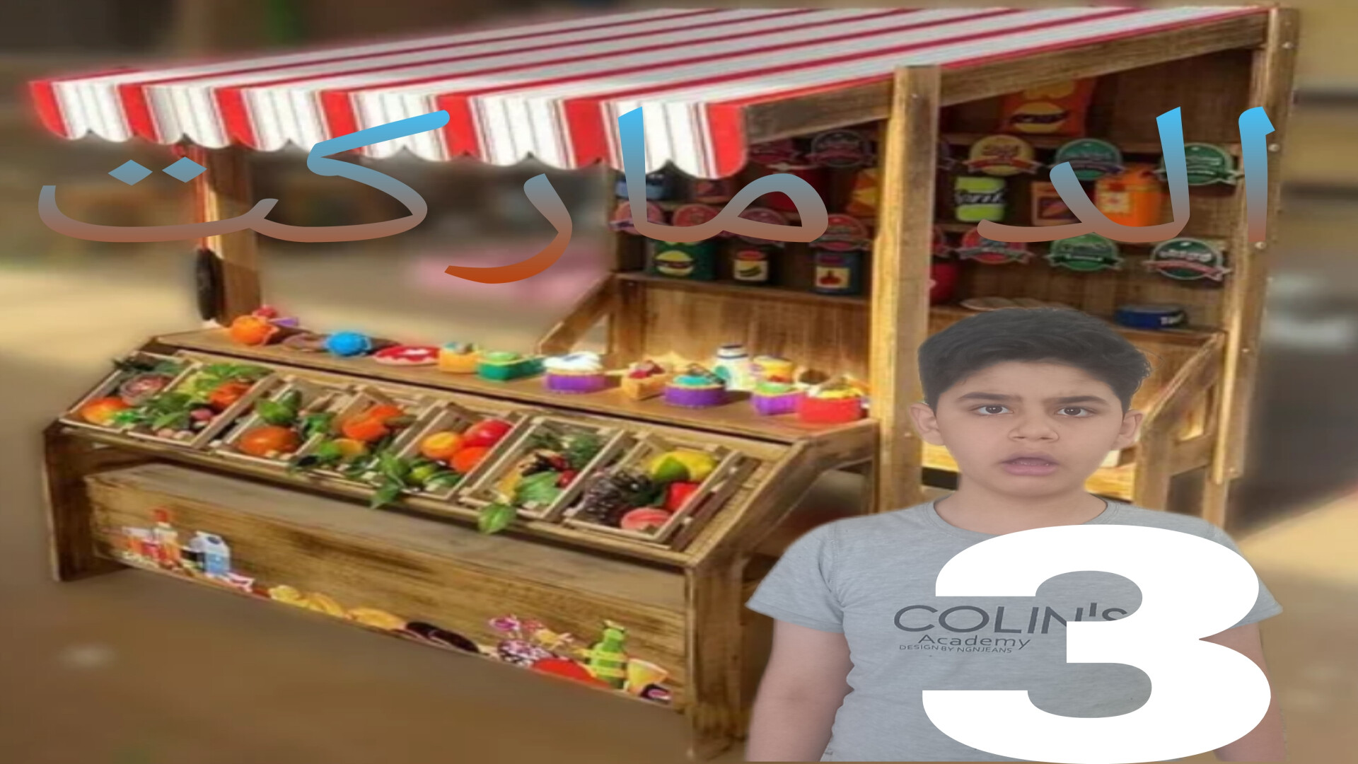 الد مارکت قسمت سوم کاشت مو