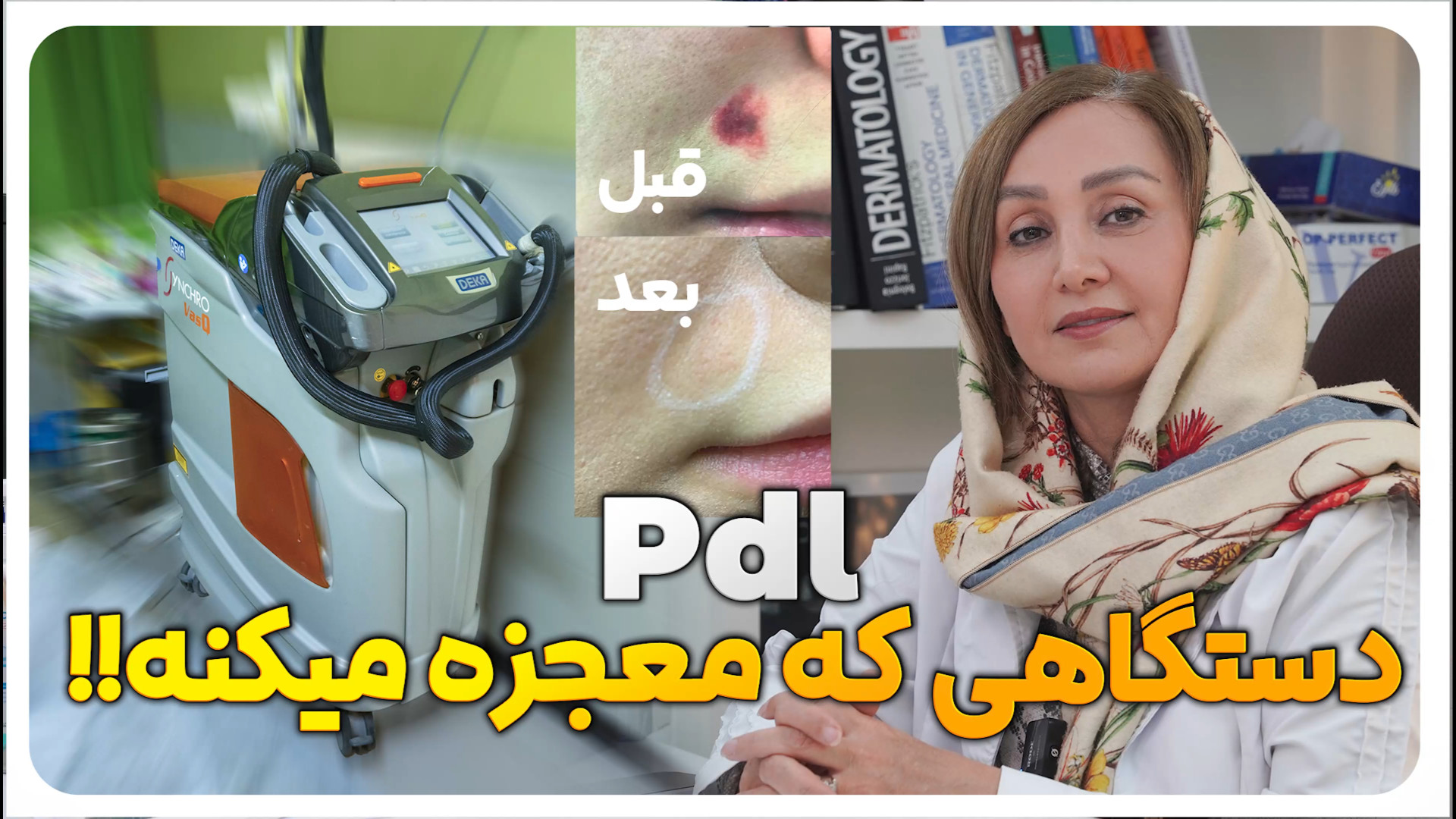 لیزر pdl درمان ماه گرفتگی، بهبود جای بخیه و جراحی، دکتر فرزانه دلگشایی مرکز جراحی کسری ،کلینیک بهاران ، دندانپزشکی نیکان