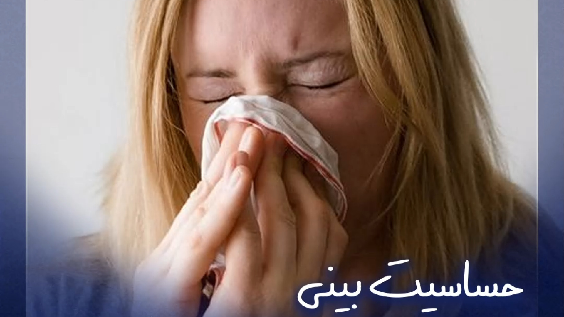 حساسیت بینی بعد از عمل | جراح بینی رشت | دکتر نجمی ماکروسفالی