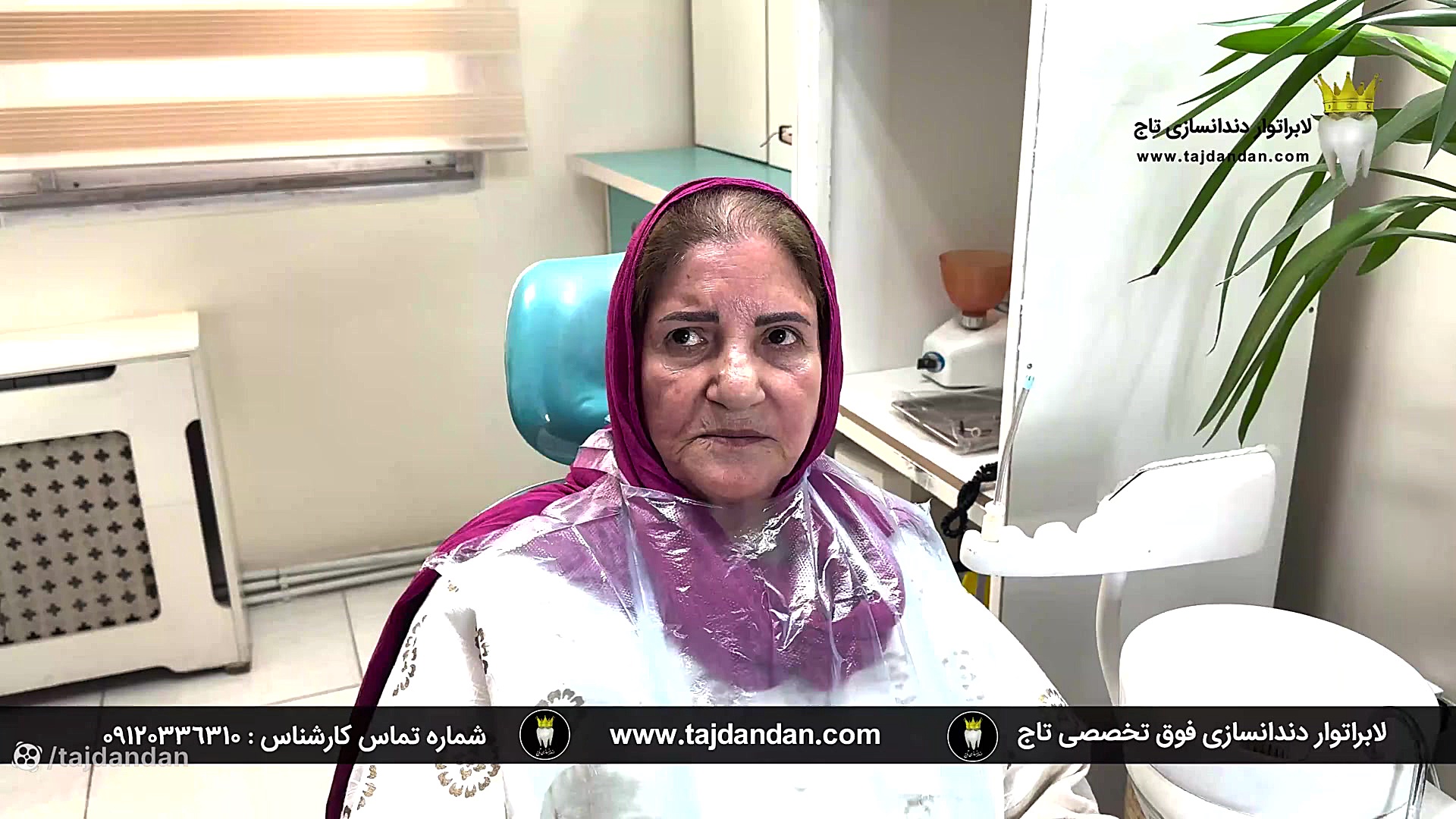 رضایت بیمار 71 ساله با تحلیل لثه شدید از ساخت پروتز دندان متحرک ایووبیس سوئیسی برداشتن خال