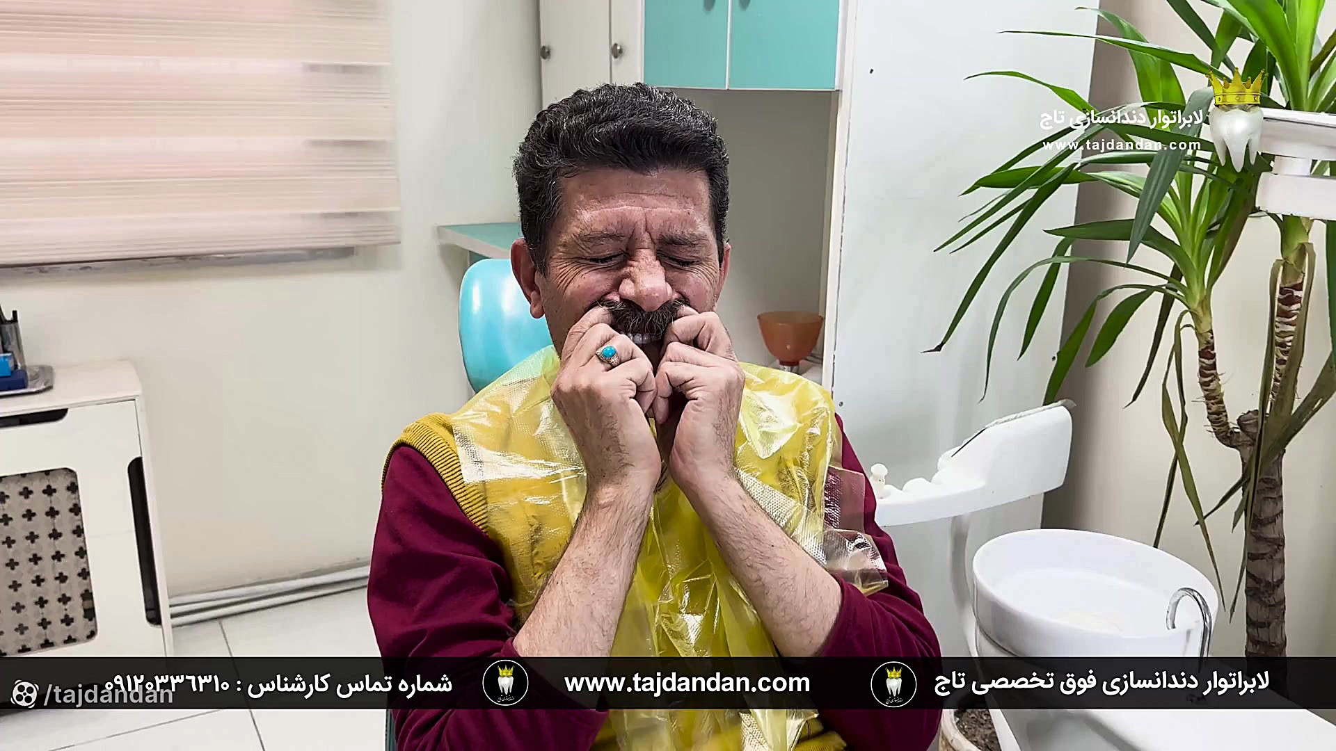 رضایت بیمار اصفهانی با لثه چاقویی از ساخت پروتز دندان متحرک ایووبیس سوئیسی جراحی پف زیر چشم