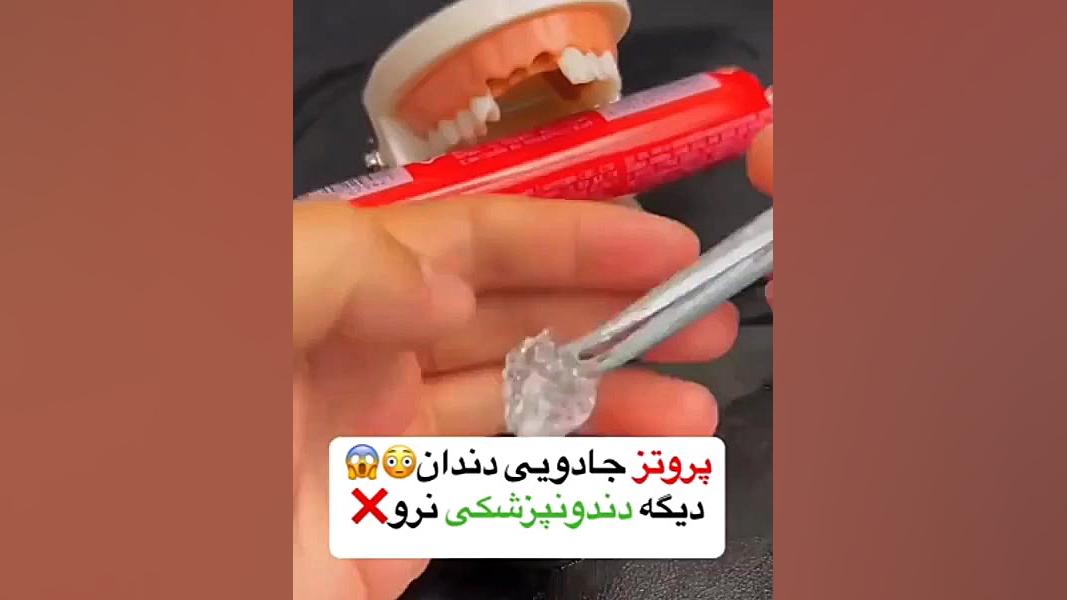 پروتز دندان جادویی مدل South Moon اصلاح فرم صورت
