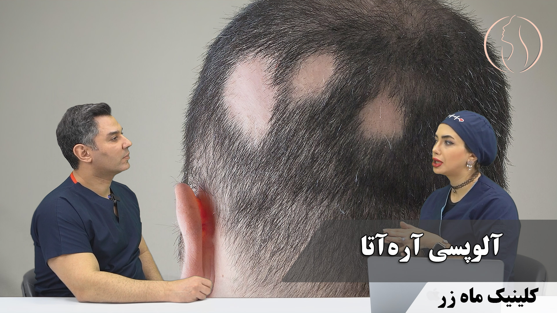آلوپسی آره‌آتا ( هفته نامه شماره ۲۵ کلینیک پوست، مو، و لیزر ماه زر ) بیماری آمیلوئیدوز فامیلیال