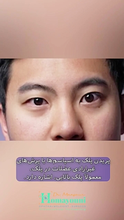 truncate dir-rtl