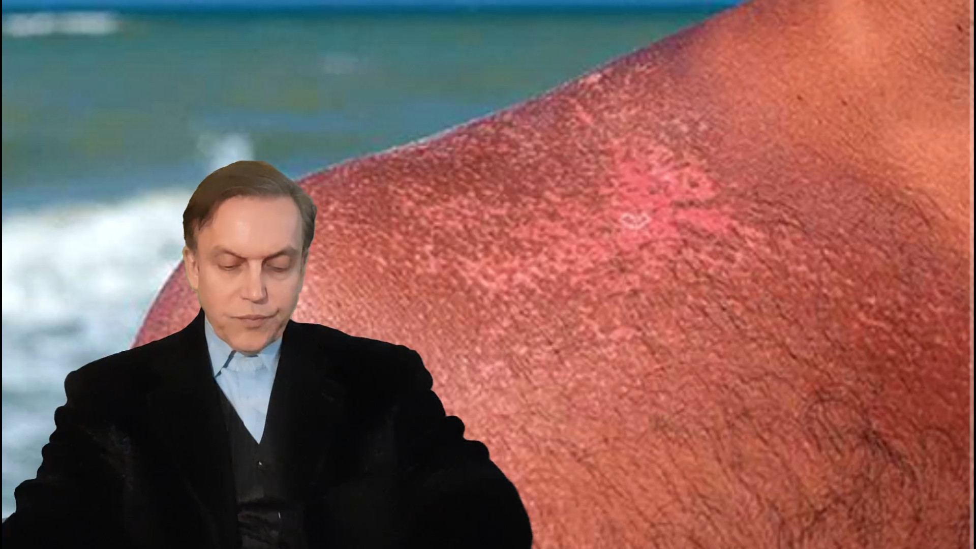 پرسش و پاسخ با استاد محمدرضا صفاری: علائم نشاندهنده بیماری آفتاب سوختگی رفع چین و چروک