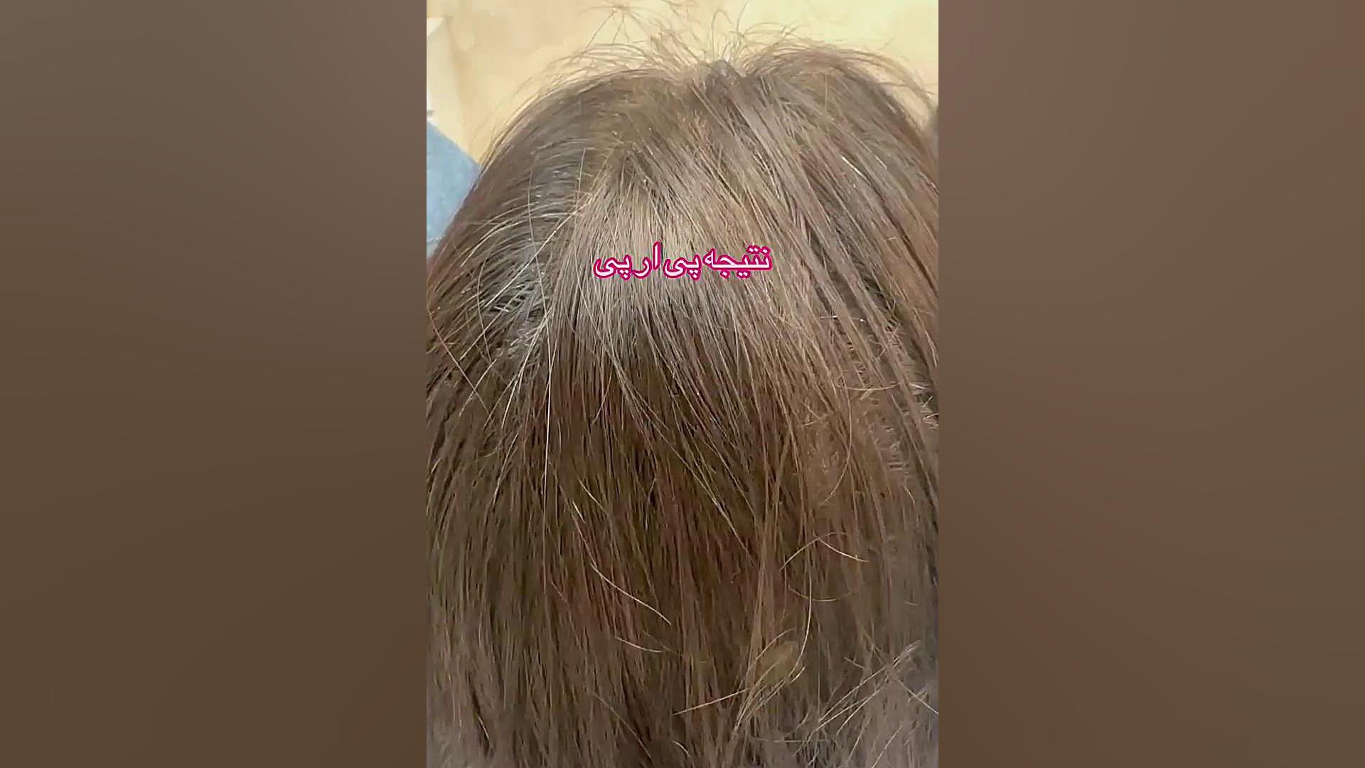 نتیجه پی ار پی دکتر فرحناز زینعلی - متخصص پوست، مو، زیبایی زنجان