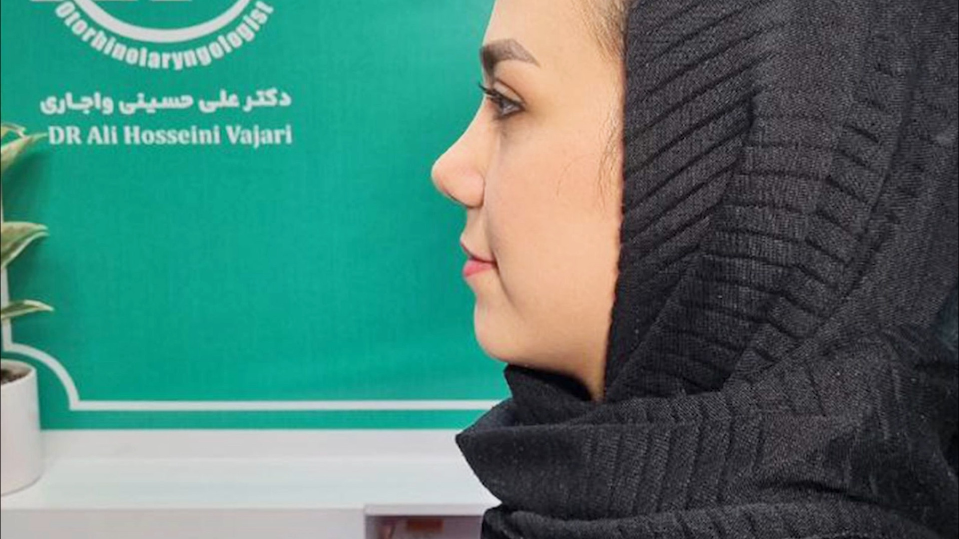 جراحی زیبایی بینی | دکتر علی حسینی واجاری دکتر علی حسینی واجاری - جراح بینی رشت