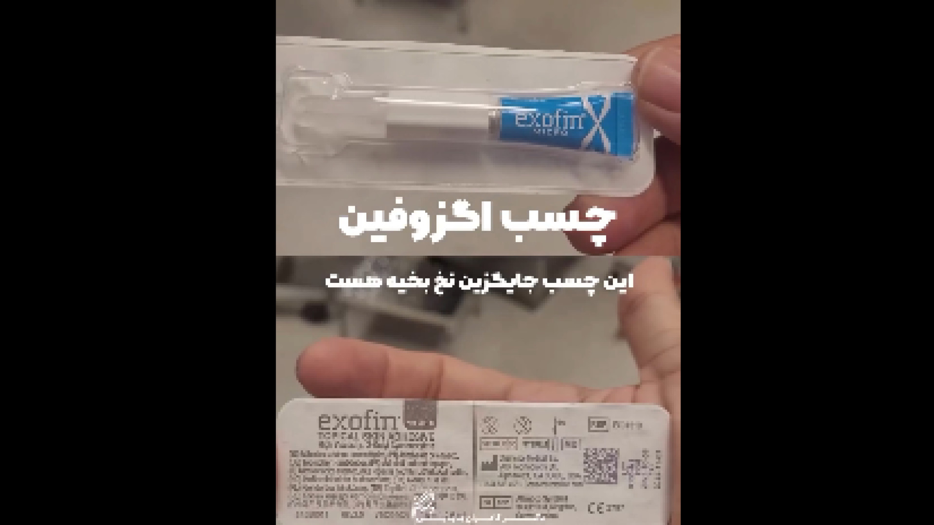 چسب اگزوفین جایگزین نخ بخیه دکتر کامران بابایی
